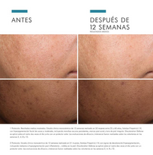 SkinCeuticals A.G.E. Interrupter Ultra Serum 30 ml | Sérum Anti-Edad Reafirmante