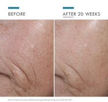 SkinCeuticals A.G.E. Interrupter Ultra Serum 30 ml | Sérum Anti-Edad Reafirmante